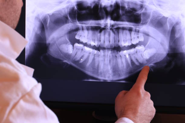 Best Emergency Dentist for Knocked-Out Tooth in La Verne, CA